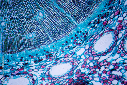 Microscopic image of Pine Stem (cross-section) photo