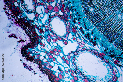 Microscopic image of Pine Stem (cross-section)