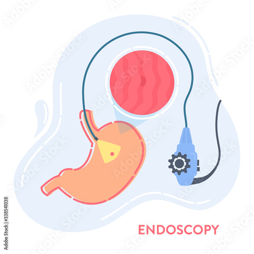 Endoscopy procedure equipment for stomach disease diagnostics. Gastrointestinal tract examination. Medical concept. Vector illustration in flat style. Human body organ anatomy and health care.
