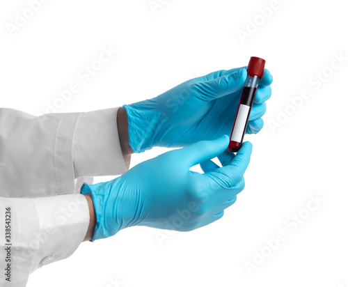 Female hand holding test tube with blood plasma isolated on white