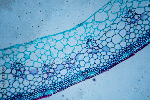 Microscopic image of wheat stem cross-section