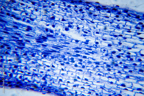 Microscopic image of plant cell mitosis cross-section