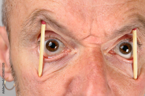 Fotografie Close up of man keeping eyes wide open with match sticks