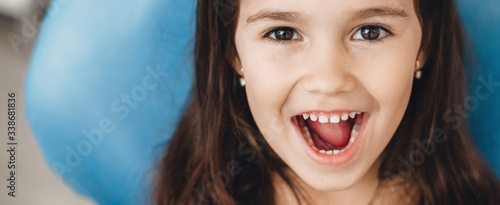 Bilde på lerret Happy caucasian girl with opened mouth smiling at camera after a teeth examinati