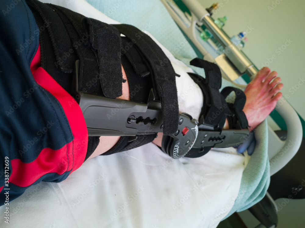 Human Leg with Patches and Orthopedic Brace After Anterior Cruciate  Ligament Surgery: in Bed at Hospital Stock Photo
