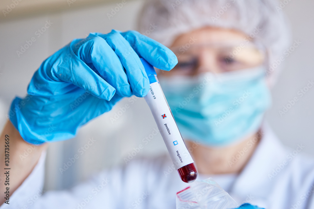 Test for Covid-19 coronavirus positive in blood sample Test for Covid-19 coronavirus positive in blood sample