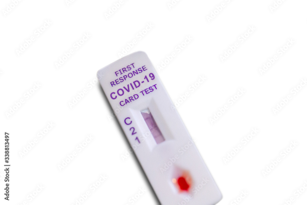 COVID-19 rapid test kit is a qualitative lateral flow immunochromatographic assay for the detection of IgM and IgG antibodies to SARS-CoV-2 in human whole blood, serum or plasma samples.