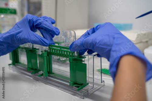 Photography The general process preparation for protein levels detection is using western blot analysis