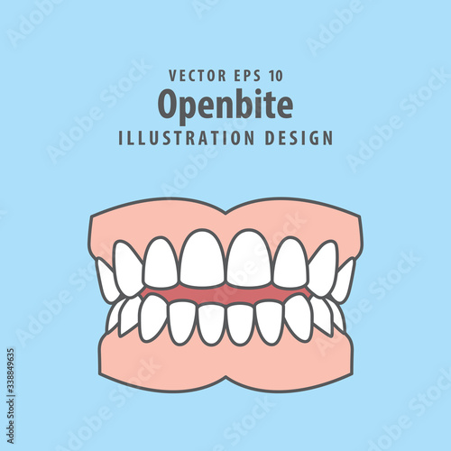 Dental openbite teeth illustration vector design on blue background. Dental care concept.