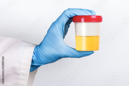 test tube with a urine test in the doctor's gloved hand