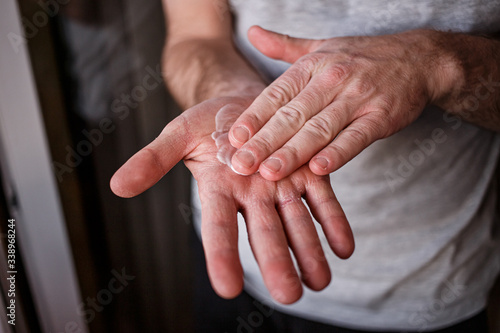 Man putting moisturizer onto his hand with very dry skin and deep cracks with cream due to washing alcohol on Covid19 situation. Horizontal close up of the inside of a very sore dry cracked male hand