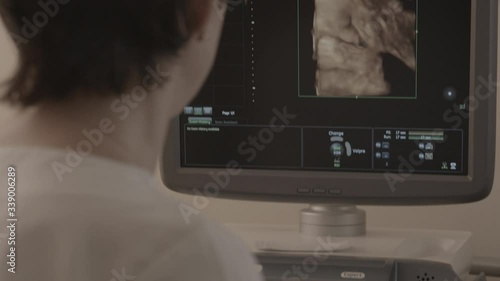 ultrasound doctor examines a pregnant girl, belly of a pregnant girl