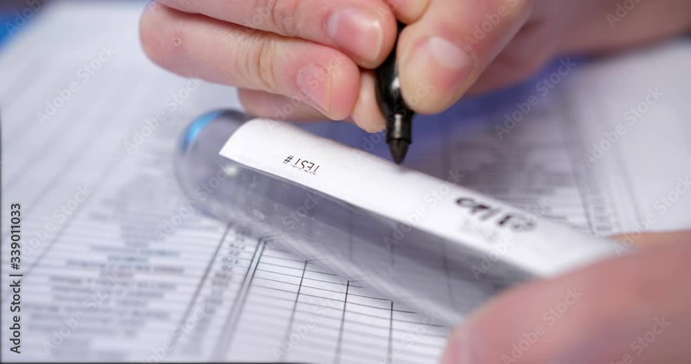 Close up detail of COVID-19 test results in the lab with a doctor writing specifications on the lab analysis Close up detail of COVID-19 test results in the lab with a doctor writing specifications on the lab analysis