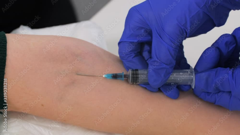 Closeup of blood sampling from vein. The doctor's hands in blue sterile gloves collect blood into the syringe from the patient's vein. Coronavirus scan. Health concept and testing Closeup of blood sampling from vein. The doctor's hands in blue sterile gloves collect blood into the syringe from the patient's vein. Coronavirus scan. Health concept and testing