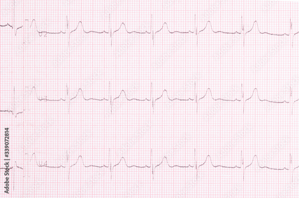 cardiogram result of the study of the heart top view, background closeup