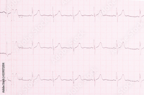 cardiogram result of the study of the heart top view, background closeup