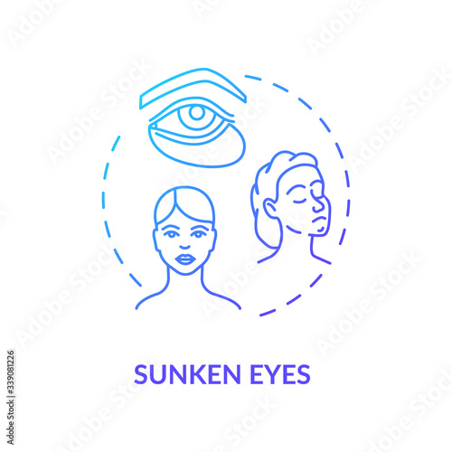 Sunken eyes blue concept icon. Lack of sleep sign. Dark circles from sleeplessness. Tired woman. Rotavirus symptom idea thin line illustration. Vector isolated outline RGB color drawing