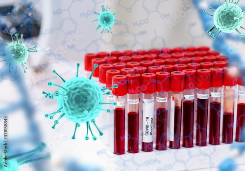 Covid-19 infected blood sample in vacuum tube in research laboratory