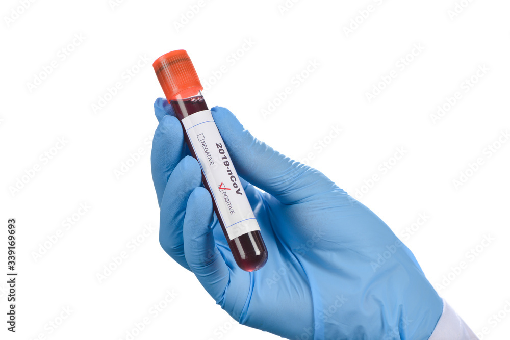 Obraz premium Coronavirus Test Positive