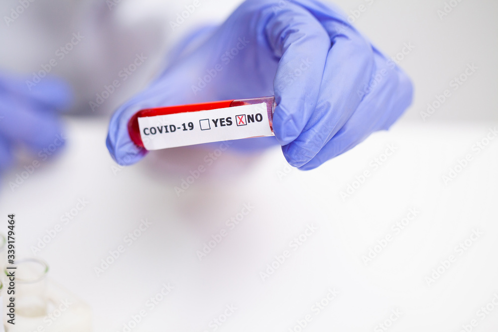 Obraz premium Doctor holds test tube with covid-19 test.