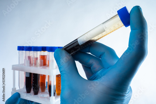 Doctor took one of the tubes with blood. Concept - analysis of human blood. Doctor checks what type of blood a person has. Redblood cells. Stand with patient analyzes on a light background. photo