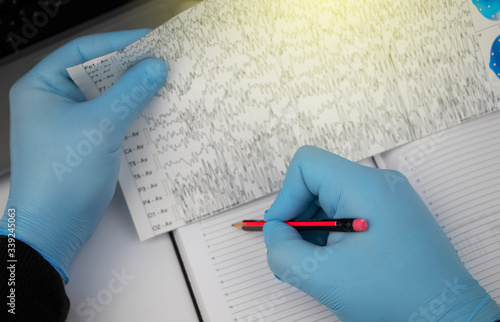 A neurologist examines an encephalogram of a patient’s brain. Schedule of electroencephalograms - study of brain currents for signs of epilepsy and pathologies of the nervous system photo