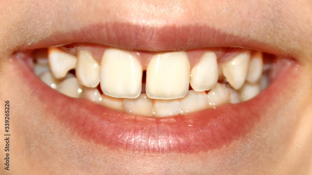 Obraz premium smile teeth beautiful tender white