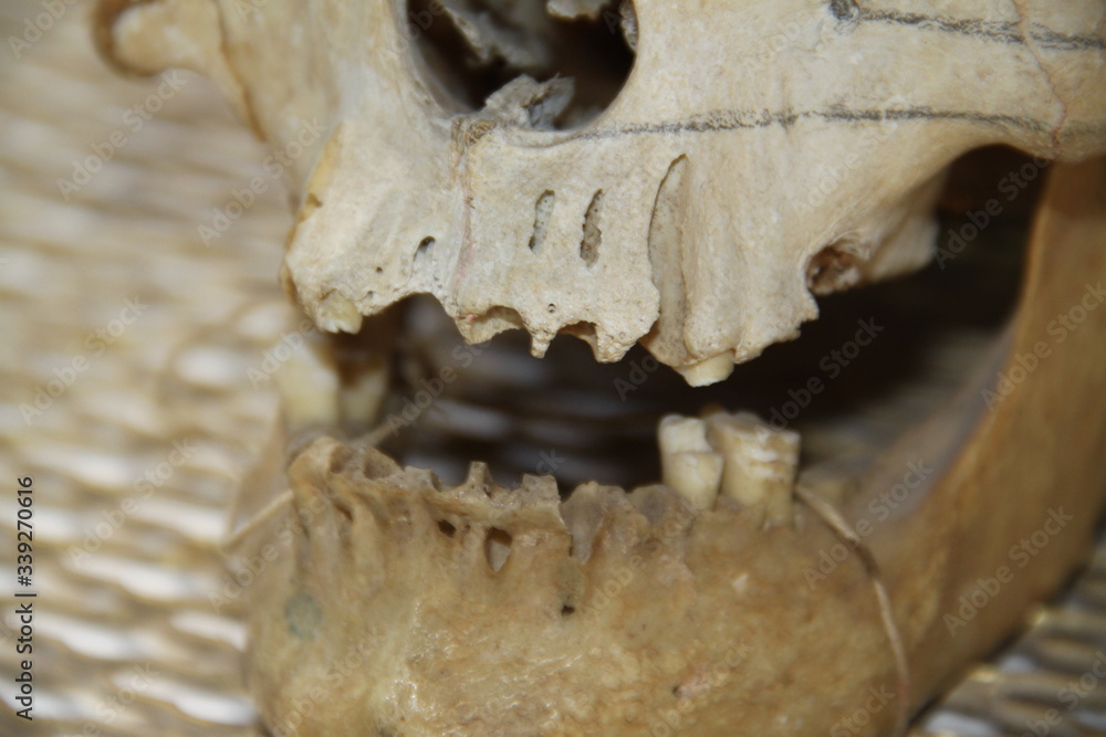 Human skull skeleton part for medicine education Human skull skeleton part for medicine education