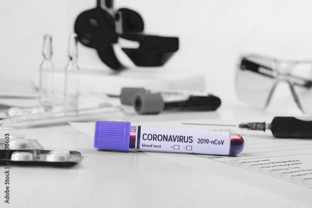 Coronavirus 2019-nCoV concept still life with blood test, drugs and laboratory flasks. COVID-19 background.