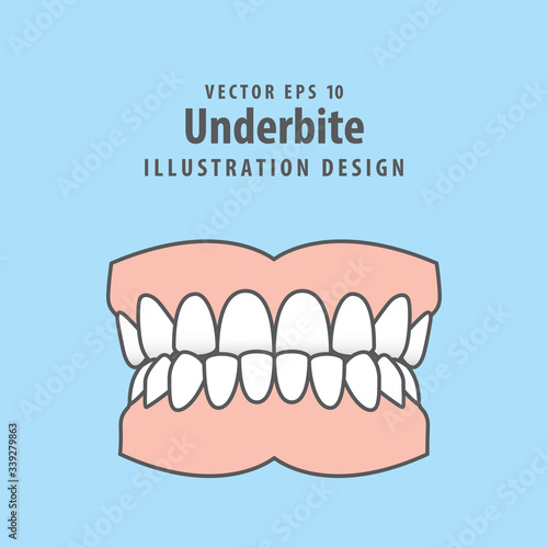 Dental underbite teeth illustration vector design on blue background. Dental care concept.