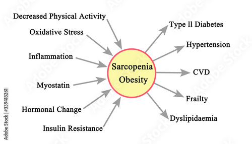  Causes and Consequences of Sarcopenia Obesity photo