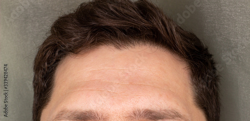 Forehead, upper part of a man's face