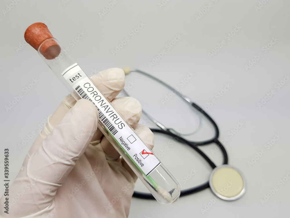 Naklejka premium Test sample positive swab for coronavirus COVID-19