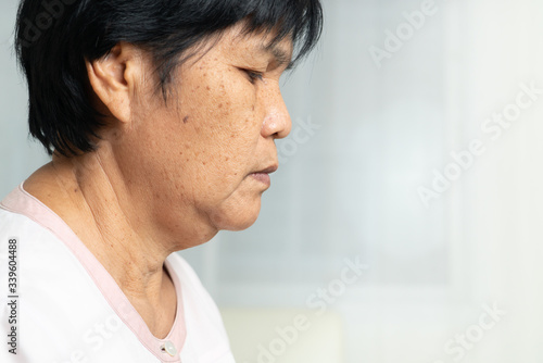 Photos Close-up of Asian elder woman face with wrinkled skin condition