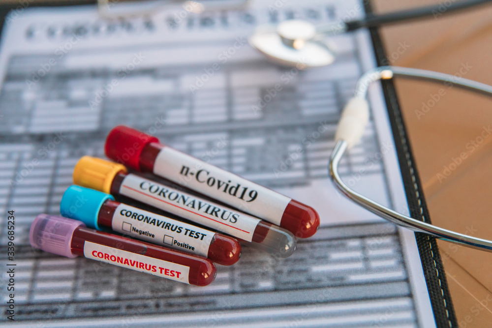 Pandemic epidemic Covid-19, 2019-nCoV or Coronavirus Blood Sample Test Tubes with patient's test result on doctor's table.