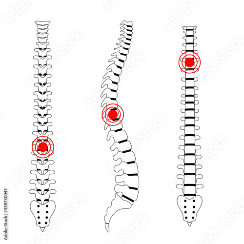 Human spine pain vector illustration
