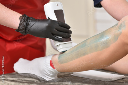 Female legs and waxing procedure with a heater. The concept of depilation, beauty and skin care.