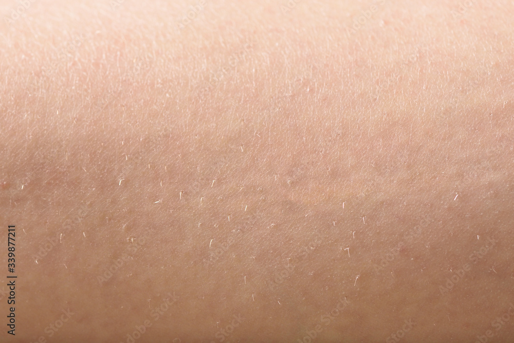 Female skin with hair on legs close-up. The concept of depilation, beauty and skin care.