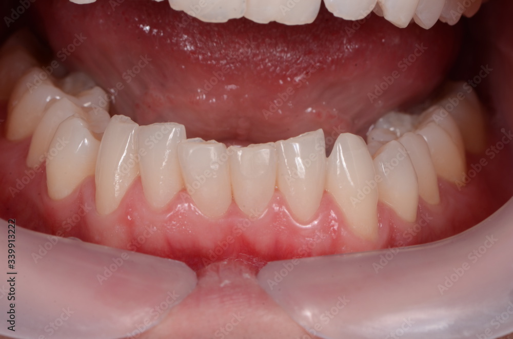 The various style of teeth The various style of teeth