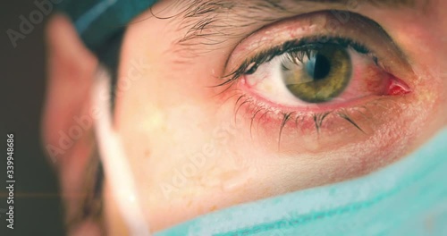 Occhi di un medico che piange. photo