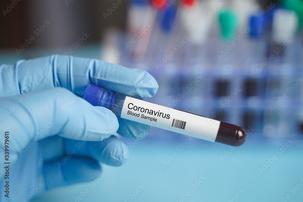 Asian doctor wearing protection suit for fighting Covid-19. He holding test tube with Positive Coronavirus test blood sample. 2019-nCoV pandemic. Asian doctor wearing protection suit for fighting Covid-19. He holding test tube with Positive Coronavirus test blood sample. 2019-nCoV pandemic.