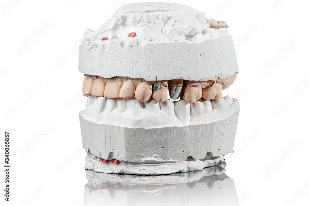 medicine, tooth, dentistry, impression, prosthesis, dentist, dental, cast, implant, denture, porcelain, mould, gum, colorful, clinic, dentition, chew, blue, mouth, square, endodontics, stone, conceptu medicine, tooth, dentistry, impression, prosthesis, dentist, dental, cast, implant, denture, porcelain, mould, gum, colorful, clinic, dentition, chew, blue, mouth, square, endodontics, stone, conceptu