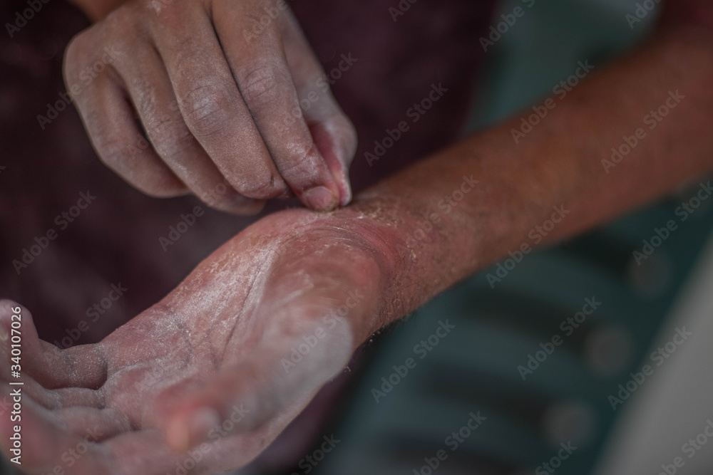 unhealthy human skin epidermis texture with flaking and cracked particles close-up.Selective focus unhealthy human skin epidermis texture with flaking and cracked particles close-up.Selective focus