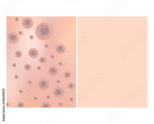 Texture with acne scars and acne. Before After scar cysts. Skin background. Infographics. Vector illustration