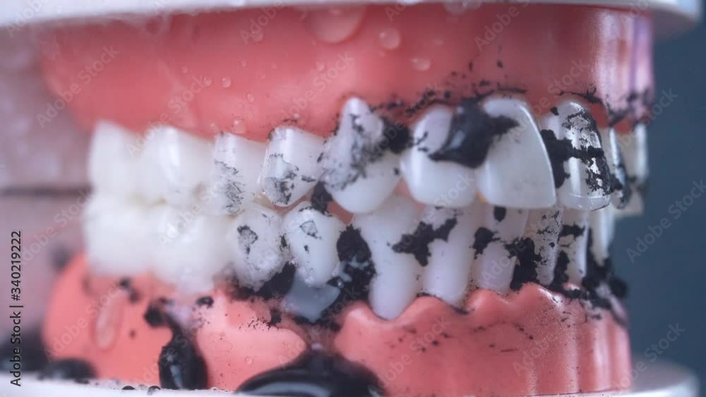 Teeth Cleaning Water Pressure Tooth jaw. Brushing teeth with a dental