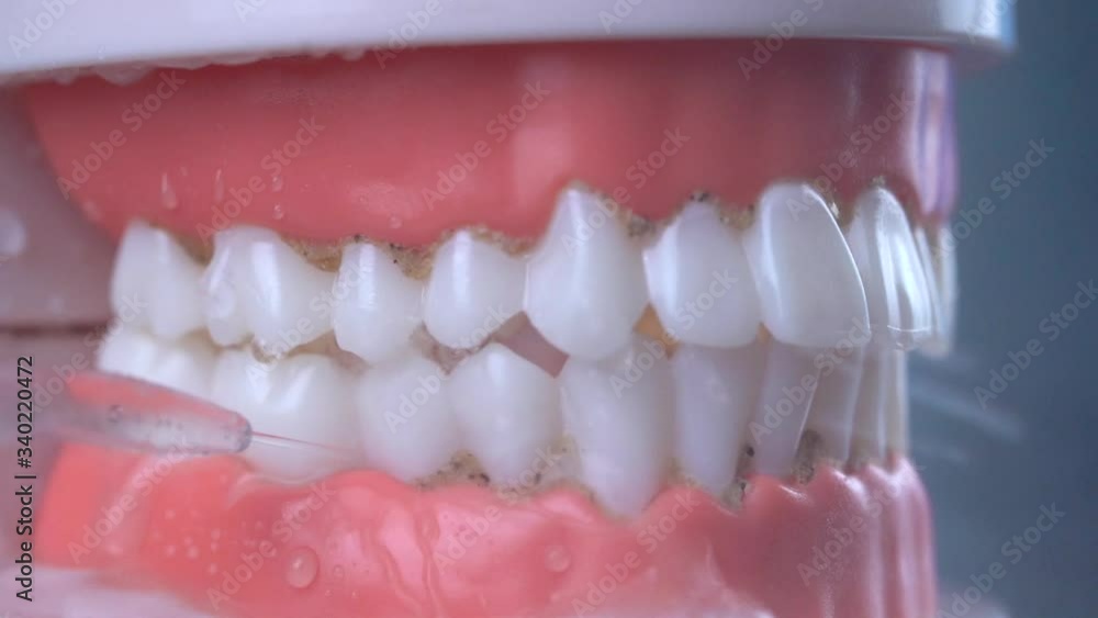 Teeth Cleaning Water Pressure Tooth jaw. Brushing teeth with a dental