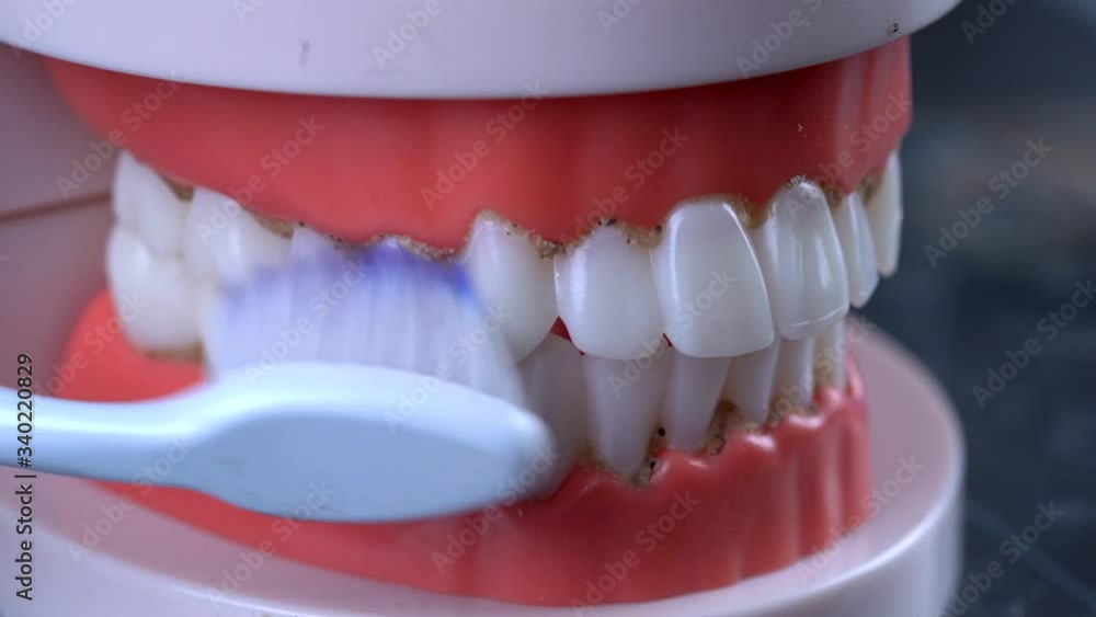 Teeth Cleaning Water Pressure Tooth jaw. Brushing teeth with a dental