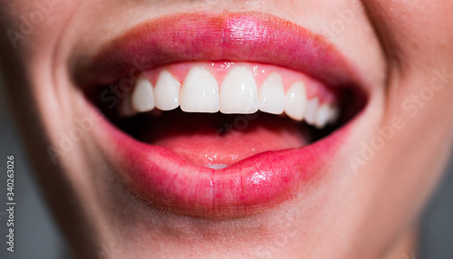 Smile teeth. Laughing woman mouth with great teeth close up. Healthy white teeth. Closeup of smile with white healthy teeth.