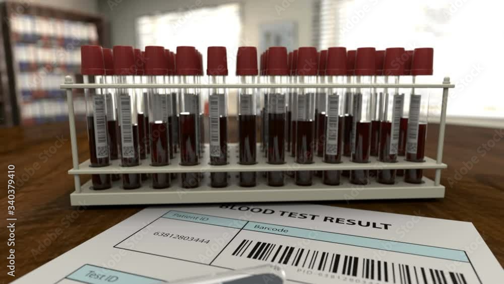 Blood test is negative for virus detection. Patient is healthy and can be quarantined while stay home. Doctors continue to examine blood tests for the virus infection. All barcodes are fake. Blood test is negative for virus detection. Patient is healthy and can be quarantined while stay home. Doctors continue to examine blood tests for the virus infection. All barcodes are fake.