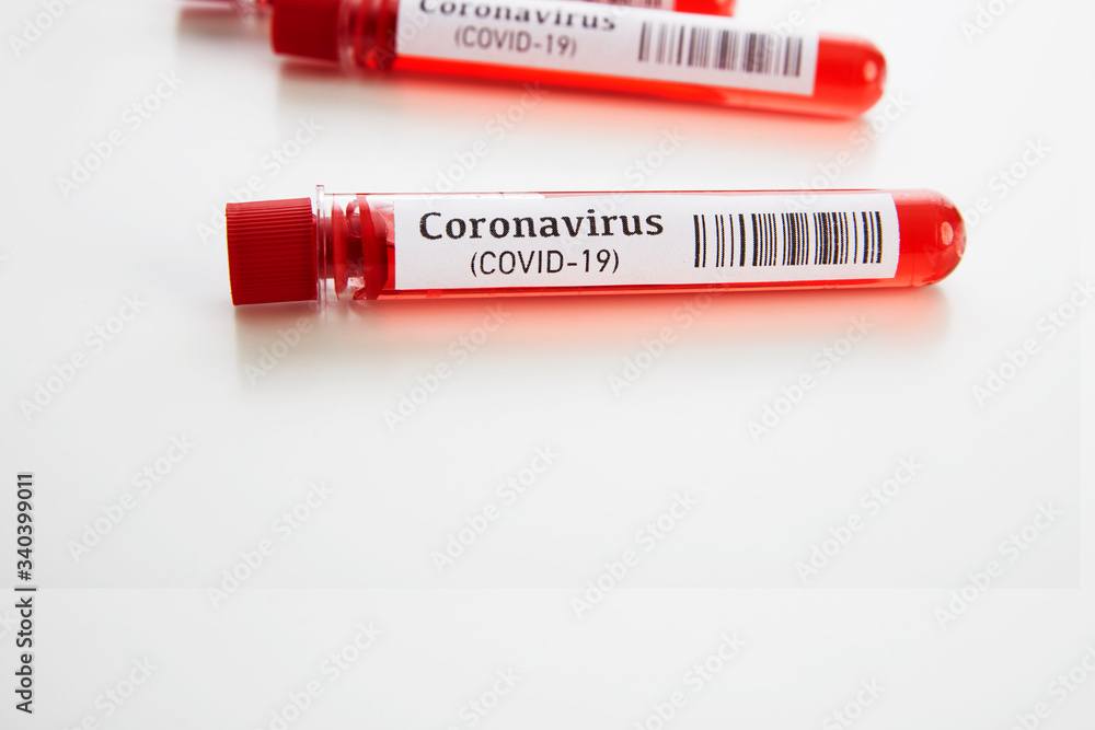 Coronavirus Blood Test in Laboratory Coronavirus Blood Test in Laboratory